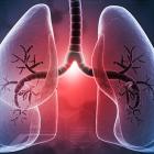 آسیب‌زایی نانوالیاف‌ها بیشتر به شکل آن‌ها وابسته است تا ترکیب شیمیایی